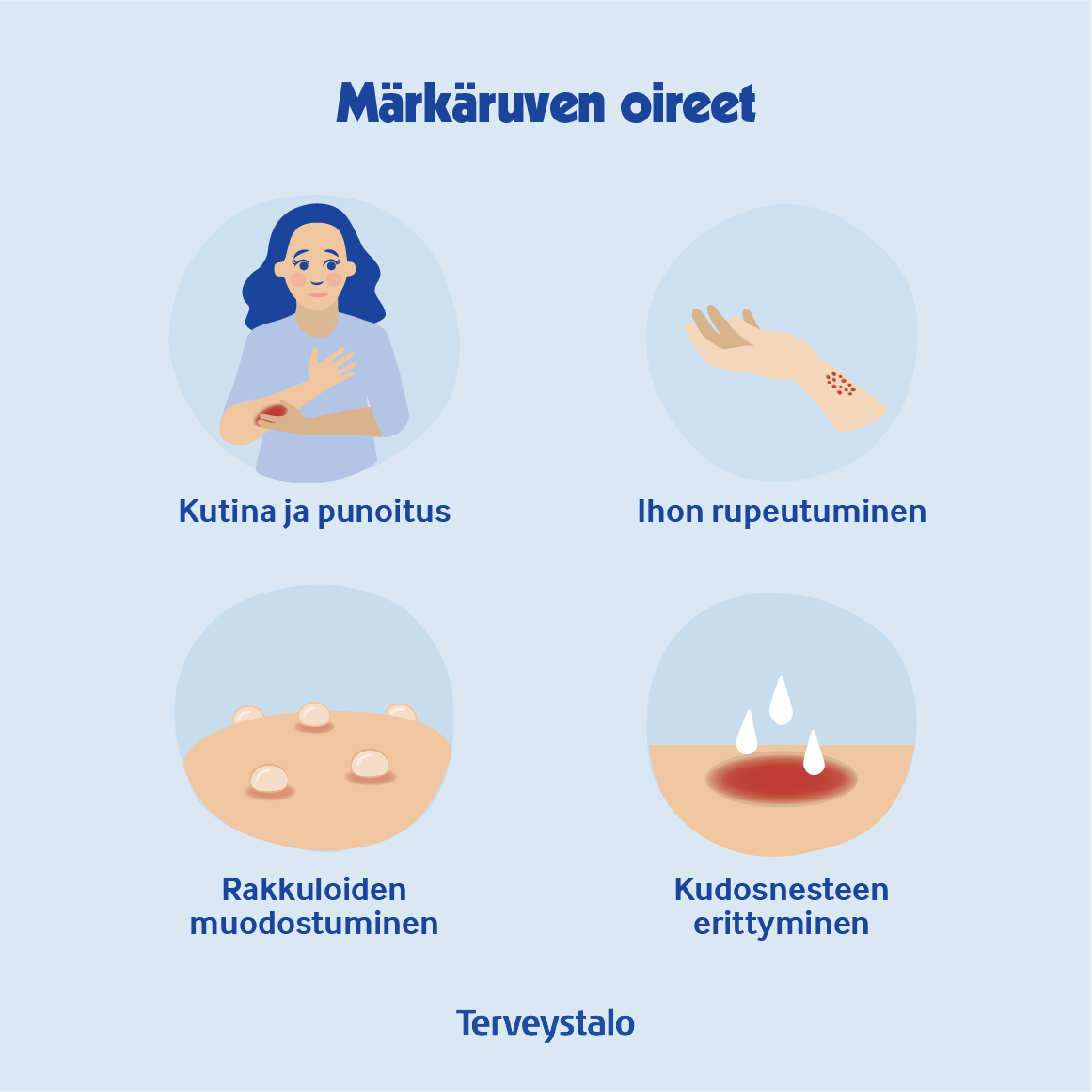M rk rupi Hoito Yleist Tietoa Terveystalo