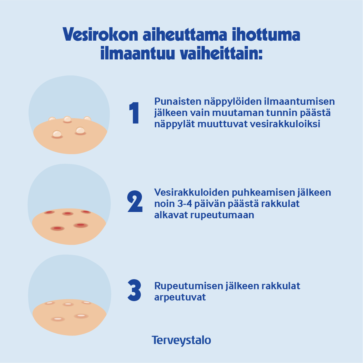 vesirokon-aiheuttama-ihottuma.png