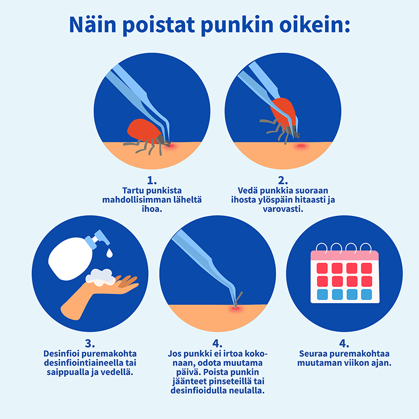 Näin poistat punkin