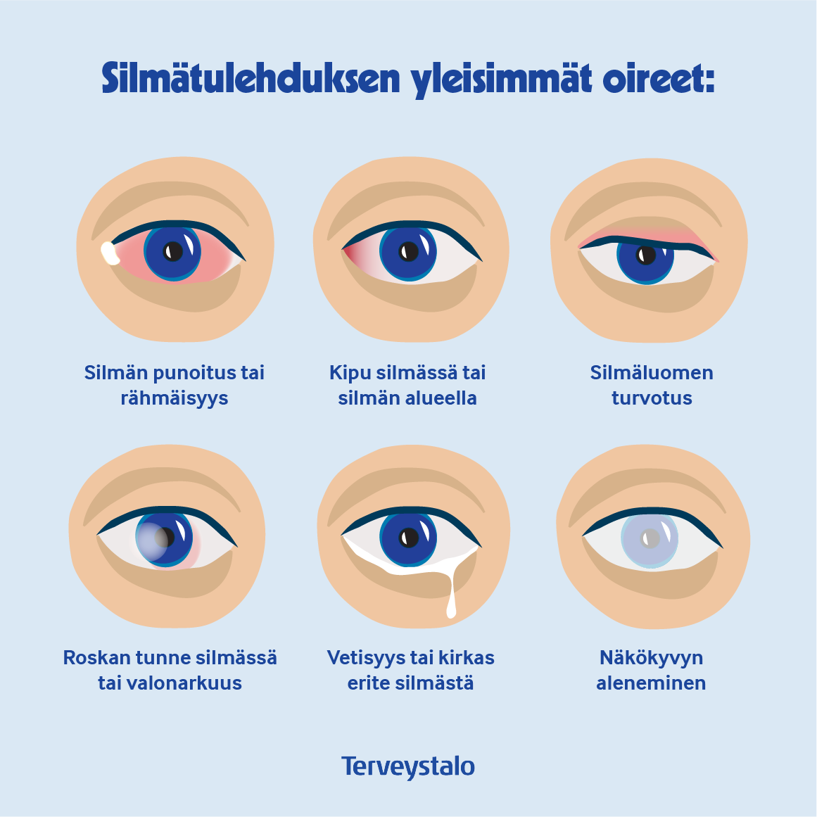 Silmätulehdus-oireet.png